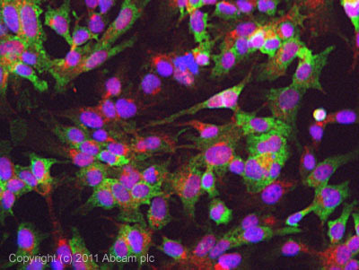 Immunocytochemistry/ Immunofluorescence - Anti-DGKA antibody (AB64845)