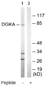 Western blot - Anti-DGKA antibody (AB64845)