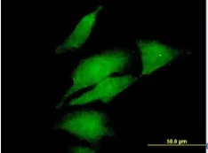 Immunocytochemistry/ Immunofluorescence - Anti-DGKA antibody (AB88672)