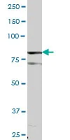 Western blot - Anti-DGKA antibody (AB88672)
