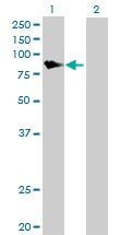 Western blot - Anti-DGKA antibody (AB88672)