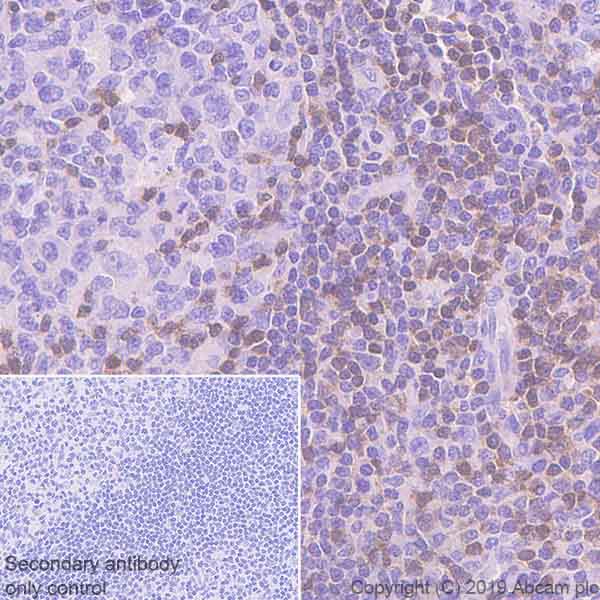Immunohistochemistry (Formalin/PFA-fixed paraffin-embedded sections) - Anti-DGKA antibody [EPR23176-101] (AB243647)