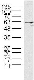 Western blot - Anti-DGKE antibody (AB218039)