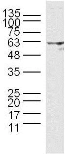 Western blot - Anti-DGKE antibody (AB218039)