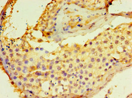 Immunohistochemistry (Formalin/PFA-fixed paraffin-embedded sections) - Anti-DGKE antibody (AB239024)