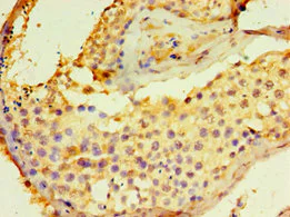 Immunohistochemistry (Formalin/PFA-fixed paraffin-embedded sections) - Anti-DGKE antibody (AB239024)