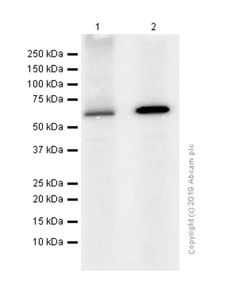 Western blot - Anti-DGKE antibody [EPR7847] (AB128949)