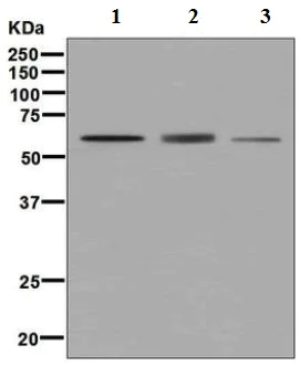 Western blot - Anti-DGKE antibody [EPR7847] - BSA and Azide free (AB248242)