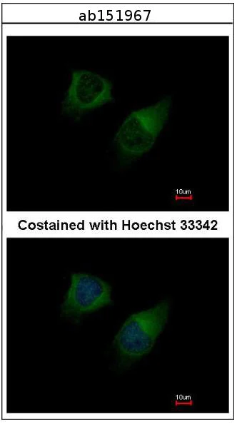 Immunocytochemistry/ Immunofluorescence - Anti-DGKG antibody (AB151967)