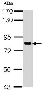Western blot - Anti-DGKG antibody (AB151967), expandable thumbnail