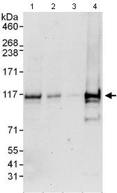 Western blot - Anti-DGKZ/DGK-zeta antibody (AB105195)
