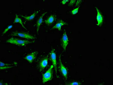 Immunocytochemistry/ Immunofluorescence - Anti-DGKZ/DGK-zeta antibody (AB234805)