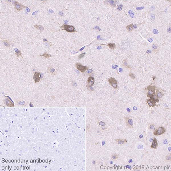 Immunohistochemistry (Formalin/PFA-fixed paraffin-embedded sections) - Anti-DGKZ/DGK-zeta antibody [EPR22040-72] (AB239080), expandable thumbnail