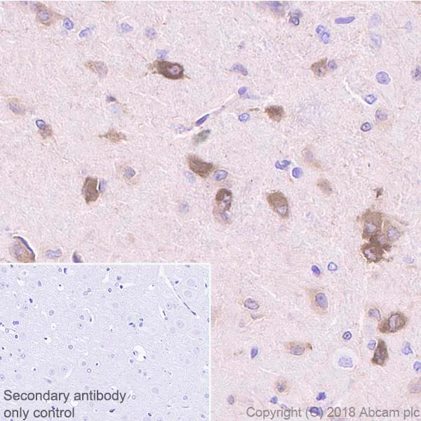 Anti-DGKZ/DGK-zeta antibody [EPR22040-72] 20 ul size (ab239080