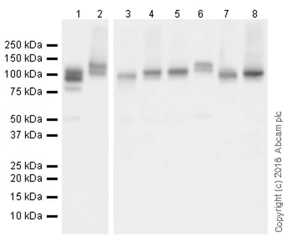 Western blot - Anti-DGKZ/DGK-zeta antibody [EPR22040-72] (AB239080)