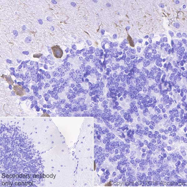 Anti-DGKZ/DGK-zeta antibody [EPR22040-80] (ab239081) | Abcam