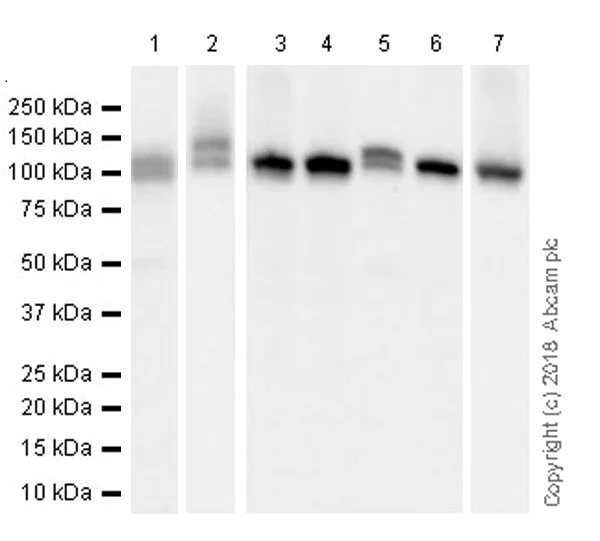 Anti-DGKZ/DGK-zeta antibody [EPR22040-80] (ab239081) | Abcam