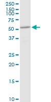 Western blot - Anti-DHCR7 antibody (AB103296), expandable thumbnail