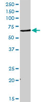 Western blot - Anti-DHCR7 antibody (AB103296), expandable thumbnail