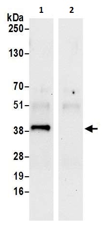 Immunoprecipitation - Anti-DHCR7 antibody (AB226409)