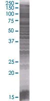 SDS-PAGE - Dhh overexpression 293T lysate (whole cell) (AB94180)