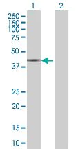Western blot - Dhh overexpression 293T lysate (whole cell) (AB94180)