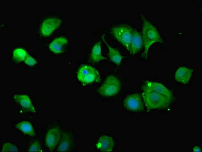 Immunocytochemistry/ Immunofluorescence - Anti-DHHC-12 antibody (AB237688)