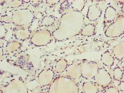 Immunohistochemistry (Formalin/PFA-fixed paraffin-embedded sections) - Anti-DHHC-12 antibody (AB237688)