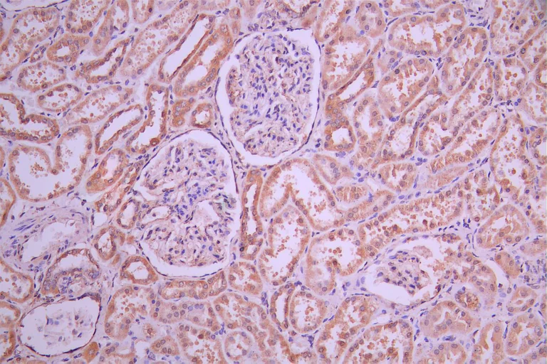 Immunohistochemistry (Formalin/PFA-fixed paraffin-embedded sections) - Anti-DHHC-12 antibody (AB237688)