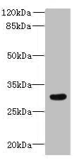 Western blot - Anti-DHHC-12 antibody (AB237688)