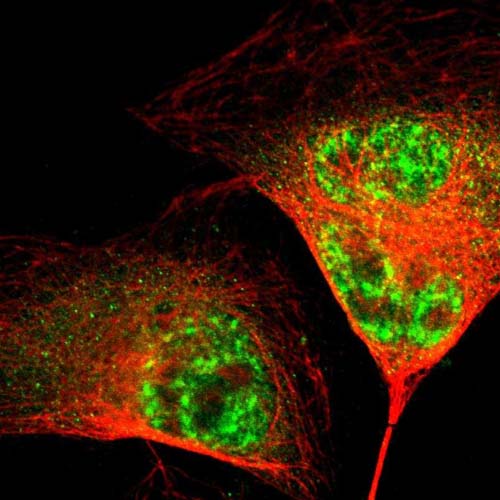 Immunocytochemistry/ Immunofluorescence - Anti-DHHC-15 antibody (AB121203)