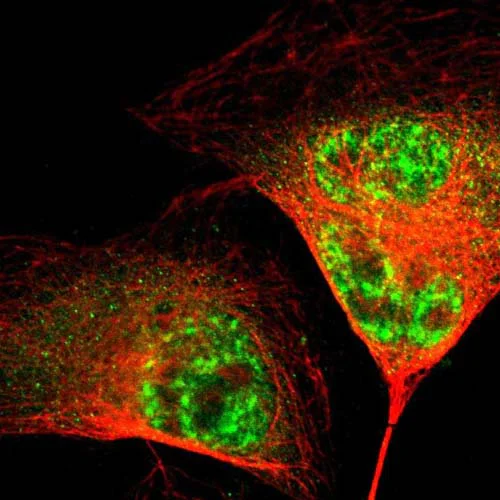 Immunocytochemistry/ Immunofluorescence - Anti-DHHC-15 antibody (AB121203)