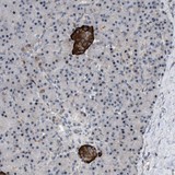 Immunohistochemistry (Formalin/PFA-fixed paraffin-embedded sections) - Anti-DHHC-15 antibody (AB121203)