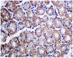 Immunohistochemistry (Formalin/PFA-fixed paraffin-embedded sections) - Anti-DHHC-18 antibody [EPR9871] (AB154790), expandable thumbnail