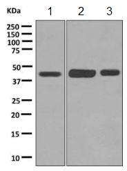 Western blot - Anti-DHHC-18 antibody [EPR9871] (AB154790), expandable thumbnail