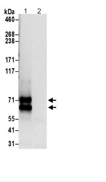 Immunoprecipitation - Anti-DHHC-5 antibody (AB200572)