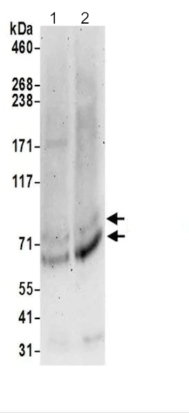 Western blot - Anti-DHHC-5 antibody (AB200572)