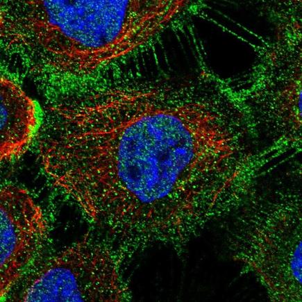 Immunocytochemistry/ Immunofluorescence - Anti-DHHC-5 antibody (AB224093), expandable thumbnail