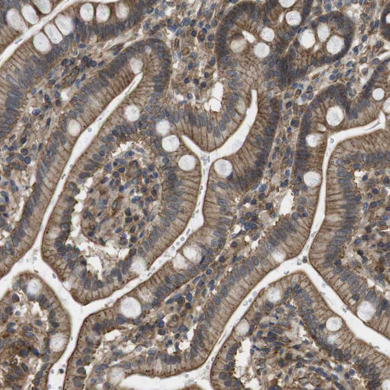 Immunohistochemistry (Formalin/PFA-fixed paraffin-embedded sections) - Anti-DHHC-5 antibody (AB224093), expandable thumbnail