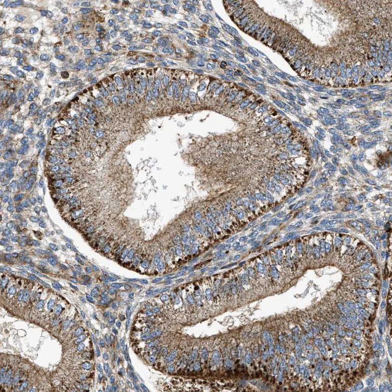 Immunohistochemistry (Formalin/PFA-fixed paraffin-embedded sections) - Anti-DHODH antibody (AB246893)