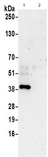Immunoprecipitation - Anti-DHPS/DHS antibody (AB190266), expandable thumbnail