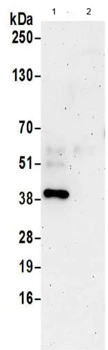 Immunoprecipitation - Anti-DHPS/DHS antibody (AB190266)