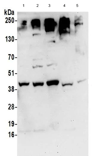 Western blot - Anti-DHPS/DHS antibody (AB190266)