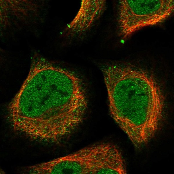 Immunocytochemistry/ Immunofluorescence - Anti-DHPS/DHS antibody (AB224134), expandable thumbnail