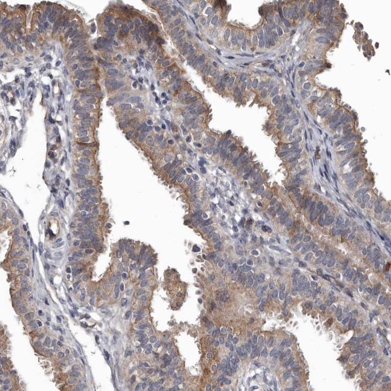 Immunohistochemistry (Formalin/PFA-fixed paraffin-embedded sections) - Anti-DHPS/DHS antibody (AB224134), expandable thumbnail