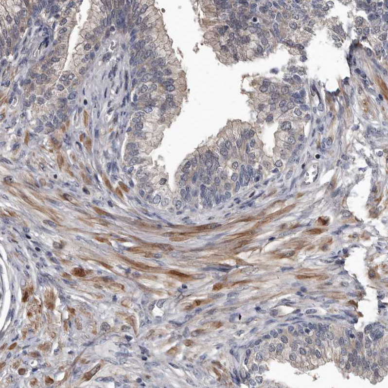 Immunohistochemistry (Formalin/PFA-fixed paraffin-embedded sections) - Anti-DHPS/DHS antibody (AB224134), expandable thumbnail