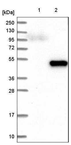 Western blot - Anti-DHPS/DHS antibody (AB224134), expandable thumbnail