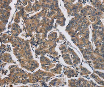 Immunohistochemistry (Formalin/PFA-fixed paraffin-embedded sections) - Anti-DHRS3 antibody (AB198005)