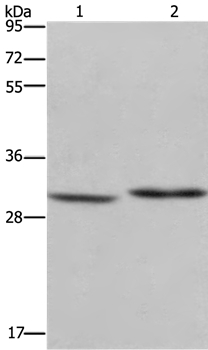 Western blot - Anti-DHRS3 antibody (AB198005)