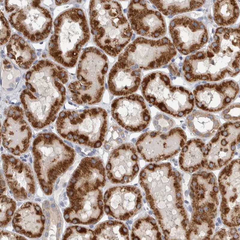 Immunohistochemistry (Formalin/PFA-fixed paraffin-embedded sections) - Anti-DHRS4 antibody (AB254702), expandable thumbnail